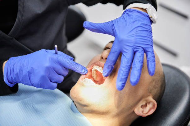 Best Emergency Gum Treatment in Muncie, IN